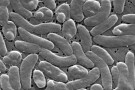 This 2005 electron microscope image provided by the Centers for Disease Control and Prevention shows Vibrio vulnificus bacteria. (Janice Haney Carr/Centers for Disease Control and Prevention via AP, File)